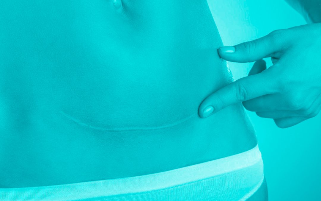 Post Partum: il recupero consapevole del corpo dopo la gravidanza