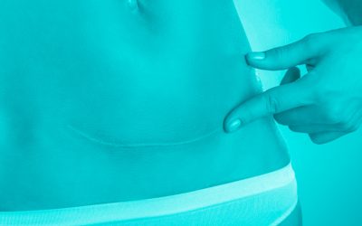 Post Partum: il recupero consapevole del corpo dopo la gravidanza
